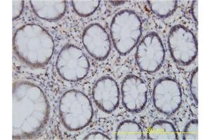 Image no. 2 for anti-Spastin (SPAST) (AA 200-304) antibody (ABIN520426)