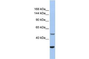 Image no. 1 for anti-Zinc Finger, ZZ-Type Containing 3 (ZZZ3) (Isoform 3), (Middle Region) antibody (ABIN1449842)