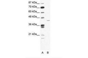 Image no. 1 for anti-Zinc Finger Protein 568 (ZNF568) (AA 121-170) antibody (ABIN202378)