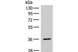 Western blot analysis of Mouse small intestines tissue lysate using FAM84A Polyclonal Antibody at dilution of 1:300