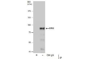 Image no. 5 for anti-Adrenergic, Beta, Receptor Kinase 1 (ADRBK1) (C-Term) antibody (ABIN2855125)