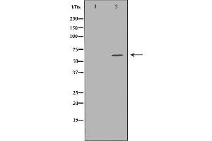 anti-Solute Carrier Family 22 Member 5 (SLC22A5) (C-Term) antibody