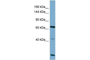 Image no. 1 for anti-P Protein (OCA2) (C-Term) antibody (ABIN2781783)