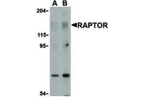 RAPTOR antibody  (N-Term)
