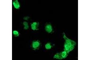 Image no. 2 for anti-Melanoma Antigen Family B, 18 (MAGEB18) antibody (ABIN2725204)