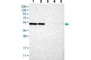 Image no. 2 for anti-Endoplasmic Reticulum Lectin 1 (ERLEC1) antibody (ABIN5649682)