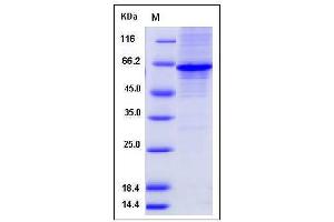 Image no. 1 for Methionyl Aminopeptidase 2 (METAP2) (AA 2-478) protein (His tag) (ABIN2007931)