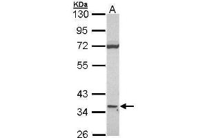 WB Image Sample (30 ug of whole cell lysate) A: Raji 10% SDS PAGE CD1D antibody antibody diluted at 1:1000