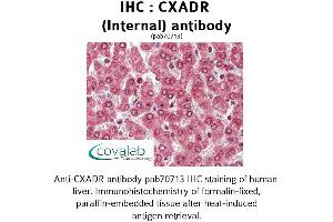 Image no. 1 for anti-Coxsackie Virus and Adenovirus Receptor (CXADR) (Internal Region) antibody (ABIN1733388)