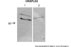 CRISPLD2 antibody  (N-Term)