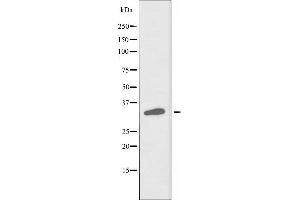 Image no. 3 for anti-Alkaline Ceramidase 3 (ACER3) antibody (ABIN6257866)