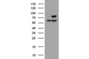 Image no. 4 for anti-Galactosidase, beta 1 (GLB1) antibody (ABIN1498467)
