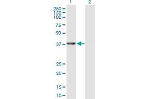 Image no. 3 for anti-RNA terminal Phosphate Cyclase Domain 1 (RTCD1) (AA 1-366) antibody (ABIN522083)