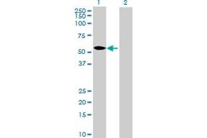 Image no. 1 for anti-Cytokine Receptor-Like Factor 3 (CRLF3) (AA 1-442) antibody (ABIN526687)