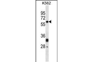 Image no. 1 for anti-N-Myristoyltransferase 2 (NMT2) (AA 125-153), (C-Term) antibody (ABIN5534554)