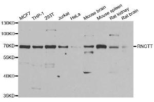 Image no. 1 for anti-RNA Guanylyltransferase and 5'-Phosphatase (RNGTT) antibody (ABIN2564993)