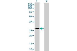 Image no. 1 for anti-XRCC6 Binding Protein 1 (XRCC6BP1) (AA 1-246) antibody (ABIN530045)