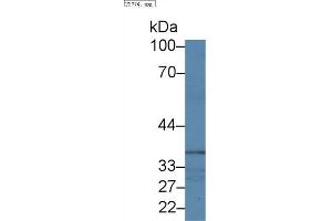 Image no. 3 for anti-NCK Adaptor Protein 1 (NCK1) (AA 2-377) antibody (ABIN5014021)