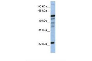 Image no. 1 for anti-Hematopoietic Prostaglandin D Synthase (HPGDS) (N-Term) antibody (ABIN6738498)