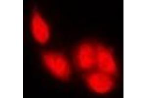Image no. 1 for anti-Nuclear Factor of Activated T-Cells, Cytoplasmic, Calcineurin-Dependent 1 (NFATC1) antibody (ABIN3198227)