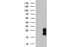 Image no. 3 for anti-Transgelin (TAGLN) antibody (ABIN2734137)
