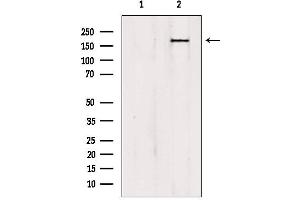 Image no. 1 for anti-Protein Tyrosine Phosphatase, Non Receptor Type 23 (PTPN23) (C-Term) antibody (ABIN6264519)