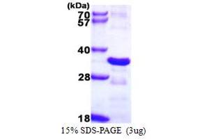Image no. 1 for Charged Multivesicular Body Protein 2B (CHMP2B) (AA 1-213) protein (His tag) (ABIN667925)