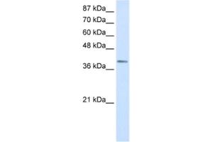 Image no. 1 for anti-LIM Homeobox Transcription Factor 1, alpha (LMX1A) antibody (ABIN2460347)