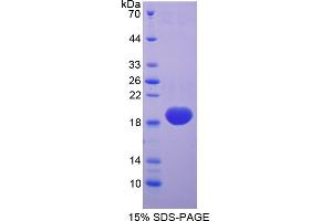 Image no. 1 for Superoxide Dismutase 1, Soluble (SOD1) (AA 2-154) protein (His tag) (ABIN6238003)