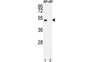 Image no. 2 for anti-E2F Transcription Factor 1 (E2F1) (AA 342-371) antibody (ABIN3030786)