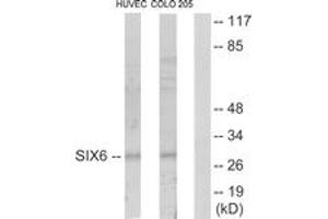 Image no. 1 for anti-SIX Homeobox 6 (SIX6) (AA 121-170) antibody (ABIN1533566)