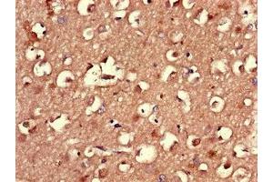 Immunohistochemistry of paraffin-embedded human brain tissue using ABIN7164558 at dilution of 1:100