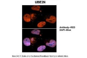 Image no. 3 for anti-Ubiquitin-Conjugating Enzyme E2N (UBE2N) (Middle Region) antibody (ABIN2778258)