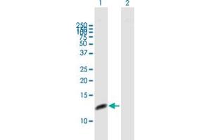 Image no. 1 for anti-Replication Protein A3, 14kDa (RPA3) (AA 1-121) antibody (ABIN948417)
