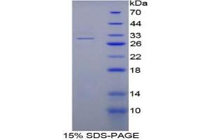 Image no. 1 for Nucleoporin 88kDa (NUP88) protein (ABIN3011008)