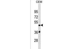 SP140L Antibody (Center) (ABIN1537899 and ABIN2849879) western blot analysis in CEM cell line lysates (35 μg/lane).