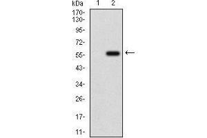 Image no. 4 for anti-Osteoactivin (GPNMB) (AA 31-260) antibody (ABIN1724859)