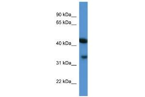 Image no. 1 for anti-ArfGAP with Dual PH Domains 1 (ADAP1) (C-Term) antibody (ABIN2784853)