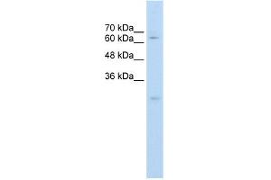 Image no. 1 for anti-Carboxylesterase 2 (CES2) (C-Term) antibody (ABIN2775271)