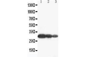 Image no. 3 for anti-Aquaporin 6, Kidney Specific (AQP6) (AA 264-282), (C-Term) antibody (ABIN3042906)