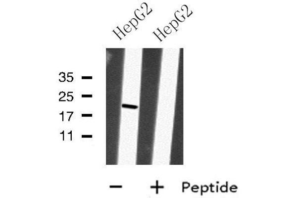 anti-Mitochondrial Ribosomal Protein S28 (MRPS28) (C-Term) antibody