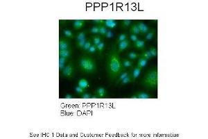 Image no. 3 for anti-Protein Phosphatase 1, Regulatory Subunit 13 Like (PPP1R13L) (Middle Region) antibody (ABIN2777612)