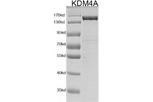 KDM4A Protein (DYKDDDDK Tag)