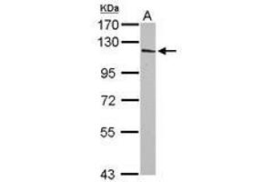 Image no. 1 for anti-Inositol Polyphosphate-4-Phosphatase, Type I, 107kDa (INPP4A) (Internal Region) antibody (ABIN1496061)