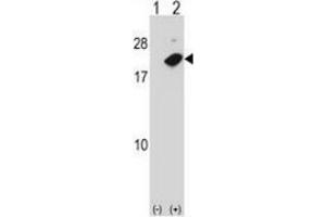 Image no. 1 for anti-Nudix (Nucleoside Diphosphate Linked Moiety X)-Type Motif 2 (NUDT2) (AA 61-90), (Middle Region) antibody (ABIN953782)