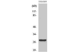 Image no. 1 for anti-CD160 (CD160) (Internal Region) antibody (ABIN3183738)