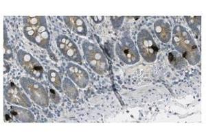 Image no. 1 for anti-Gastric Inhibitory Polypeptide (GIP) antibody (ABIN355181)