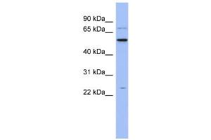 Image no. 1 for anti-Zinc Finger CCHC-Type and RNA Binding Motif 1 (ZCRB1) (N-Term) antibody (ABIN2776603)