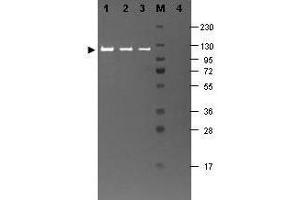 Image no. 1 for anti-Galactosidase, beta 1 (GLB1) antibody (ABIN99522)