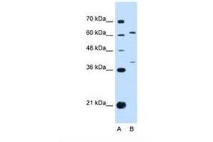 anti-Interleukin 28 Receptor, alpha (Interferon, lambda Receptor) (IL28RA) (AA 51-100) antibody